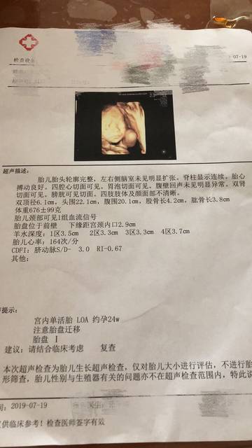 刚做了四维,医生说是男宝,谁要男宝,一胎男孩,二胎