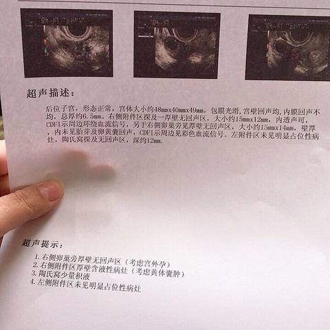 journal_insert_pic_1359998711
