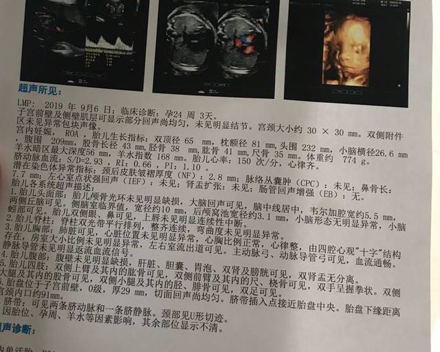 朋友都说我是个男宝,b超说买漂亮衣服,宝妈们怎么看?