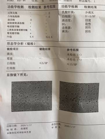 在不知道怀孕的情况下做了hpv个tct检查,结果显示hpv感染了16和43,tct