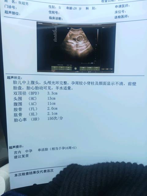 16周b超单,给看看男女啊