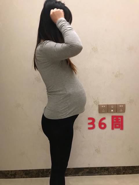 剖腹男宝 来看男宝肚子 生前108斤涨了16斤