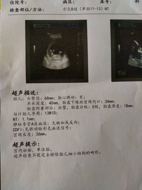 nt检查结果