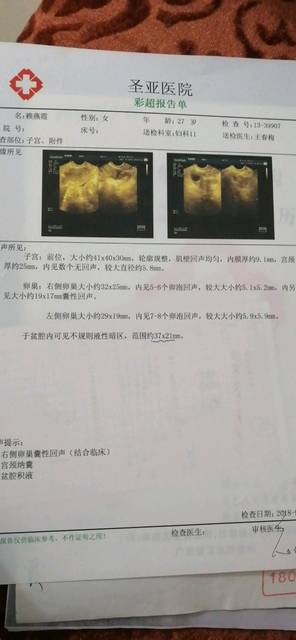 我这宫颈纳囊用不用去医院检查啊