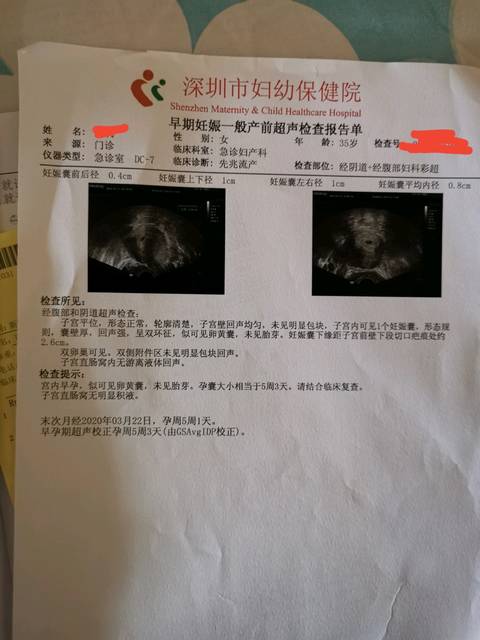 孕5周 ,有出血腰疼小腹坠疼情况,医生让保胎,保胎能成功吗?