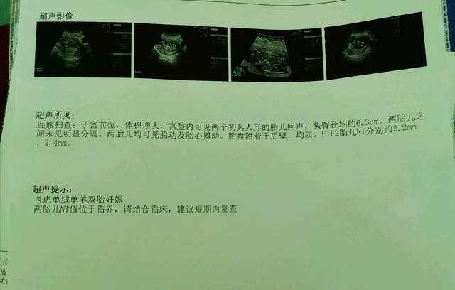 南通江苏南通供卵试管服务机构