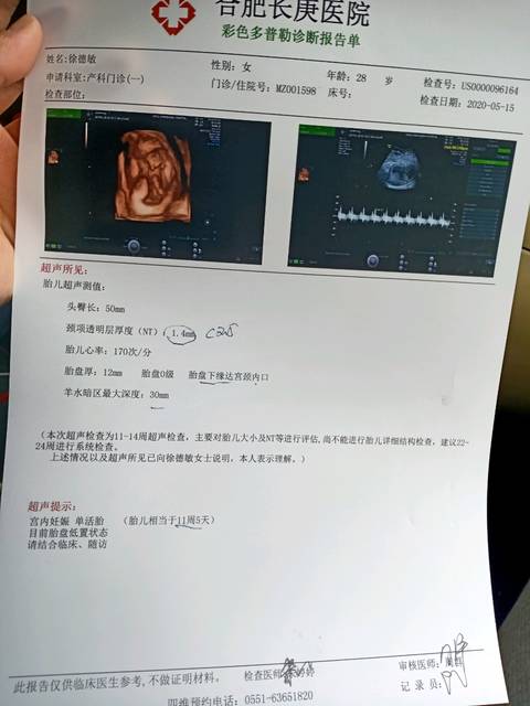 热腾腾的nt报告