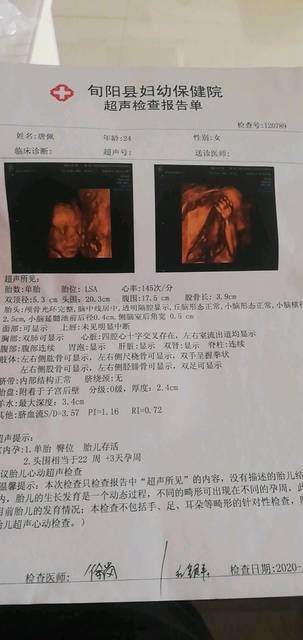 4维彩超图片