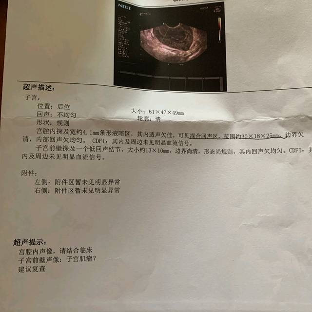 剖腹产后42天阴超