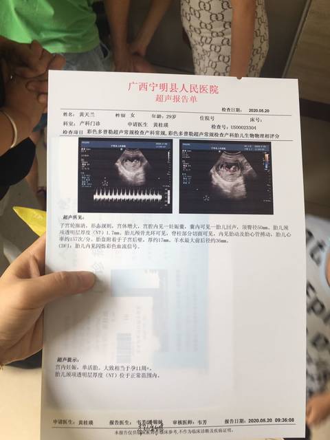 新鲜nt彩超