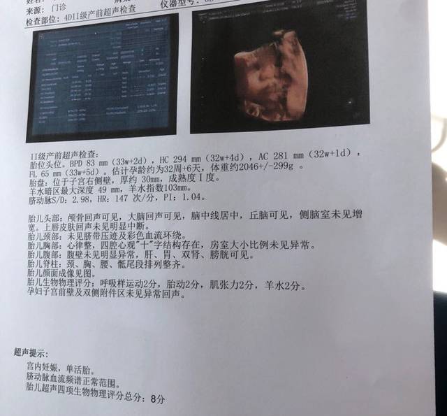 新鲜小排畸b超图.