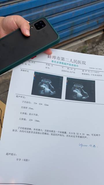 双胞胎