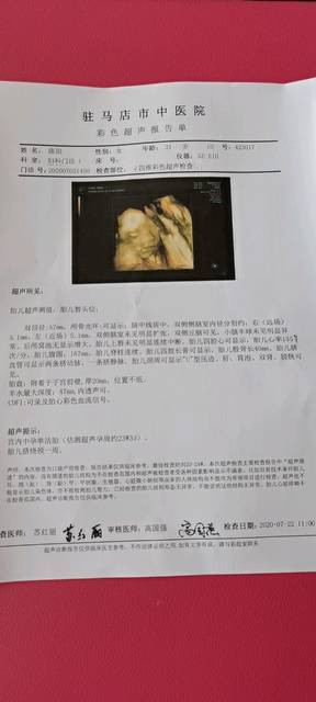 四维彩超过了_有会看男女的吗,帮忙看下_宝宝树