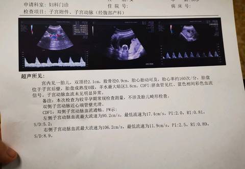 做了nt 好奇男孩女孩