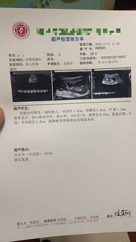 请问各位我的nt报告正常吗?胎心率164会不会太高了呀?