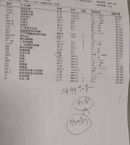 Alt Ast偏高 十几倍 医生喊住院用药保肝