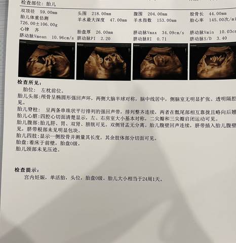 journal_insert_pic_1629038033