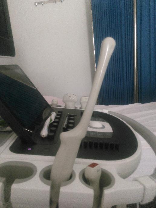 做阴氏B超是种什么体验?有何优点?看看过来人