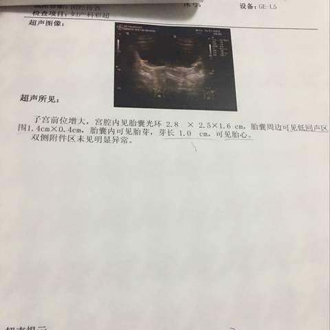 journal_insert_pic_545912497