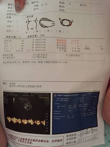 journal_insert_pic_545854286