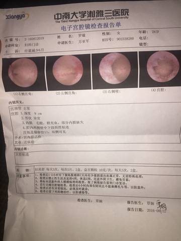 廣州宮腔鏡手術醫保報銷多少 宮腔鏡手術醫保報銷多少