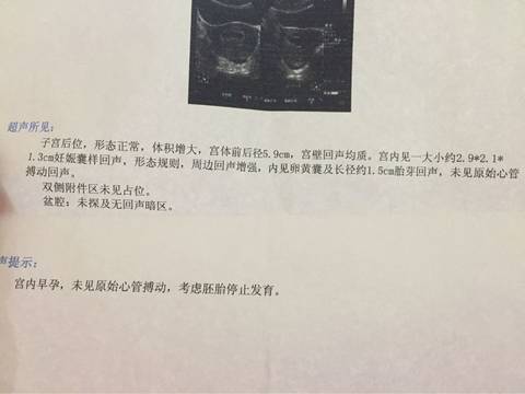 journal_insert_pic_550724025