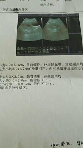 journal_insert_pic_551346222