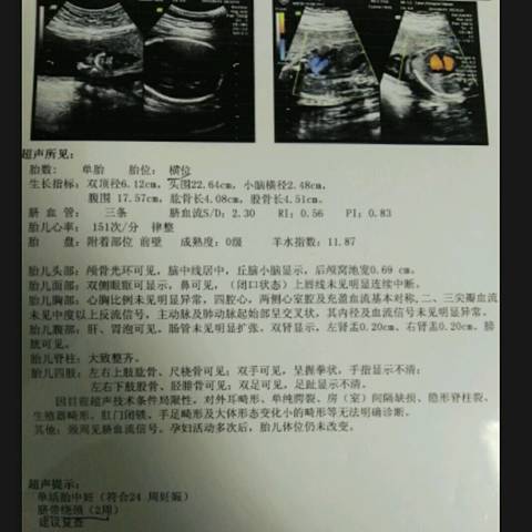 journal_insert_pic_552031109