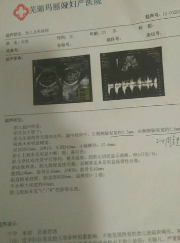 journal_insert_pic_555366695
