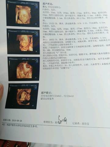 journal_insert_pic_559355094