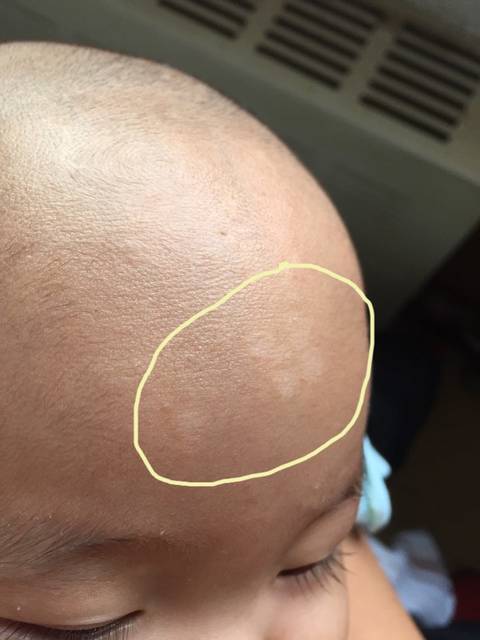 新四个月宝宝脸上有白色的小斑点看的不明显有