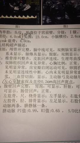 journal_insert_pic_559248478