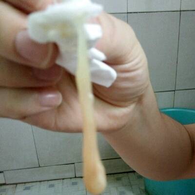 宝宝十个月了在把尿时偶尔宝宝打屁会发现从屁屁里