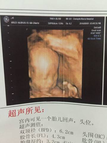 journal_insert_pic_563406198