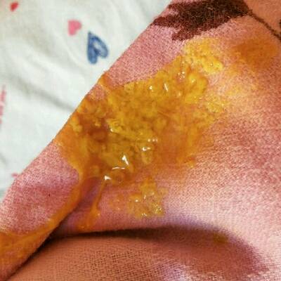 宝贝才4天,每次吃完母乳之后就拉这样的便便,是消化不良吗?