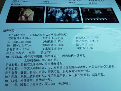 journal_insert_pic_564719200