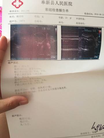 journal_insert_pic_565451455