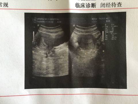 journal_insert_pic_565790232