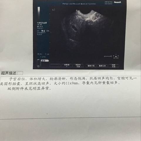 journal_insert_pic_566331149