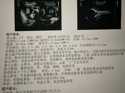 journal_insert_pic_565917507