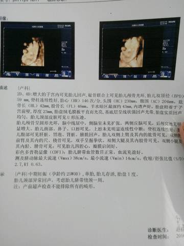 journal_insert_pic_567549706