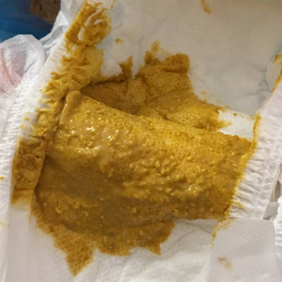 精神状况挺好的,也能吃