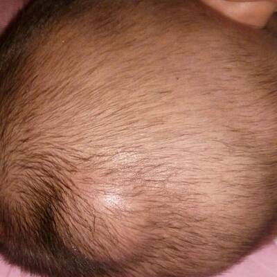 今天晚上八点带宝宝出去玩了一会,回到家宝宝就一直挠头