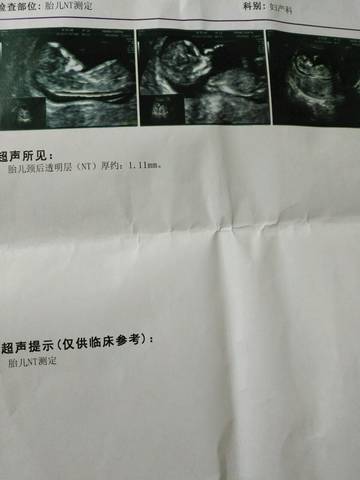journal_insert_pic_569690721