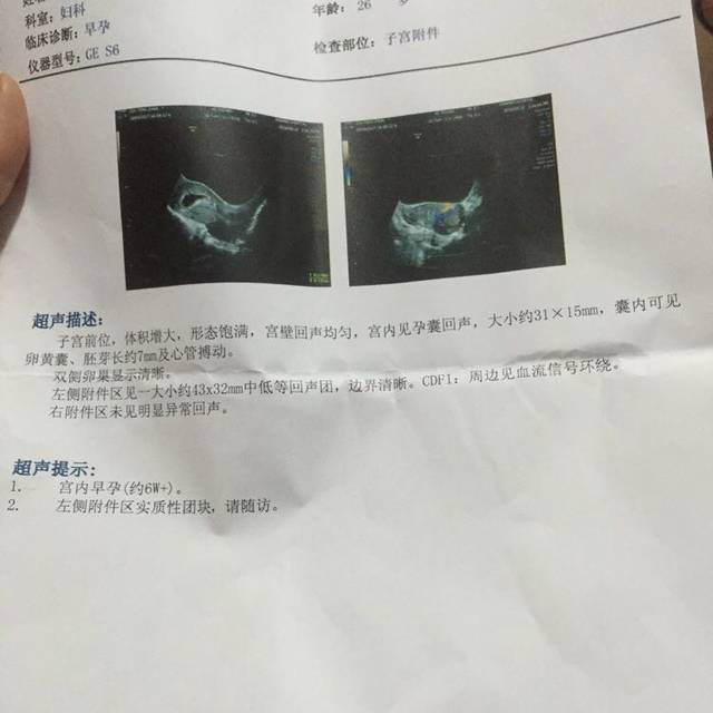 唐山早孕检查