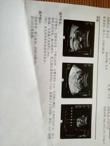 journal_insert_pic_569818743