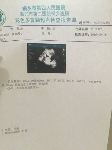 journal_insert_pic_572298715