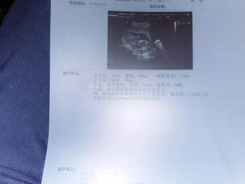 journal_insert_pic_574243665