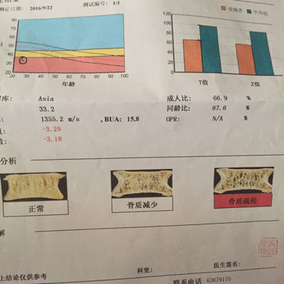 快六個月了,檢查骨密度,結果是骨質疏鬆!這可怎麼辦啊!