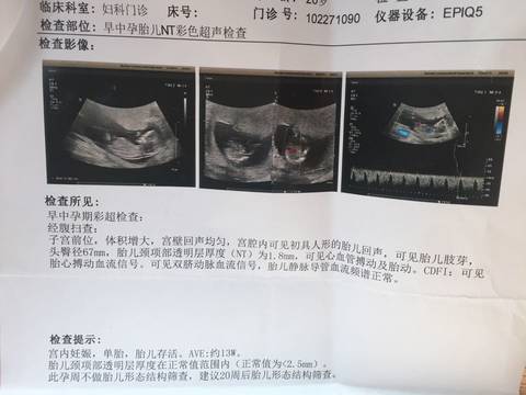 journal_insert_pic_576552622